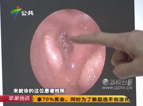 @Ӷ(ni)LMɫx˺ҧʹ