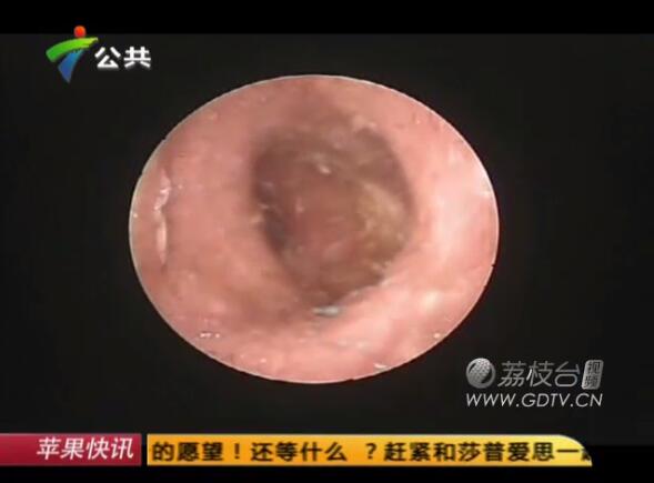 @Ӷ(ni)LMɫx˺ҧʹ